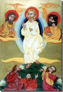 Vignazia, La Trasfigurazione