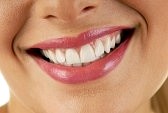 home teeth whitening procedure
