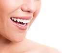 5 minute teeth whitening gel review