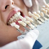 dental lab teeth whitening trays