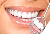 whitening teeth with baking soda and strawberries