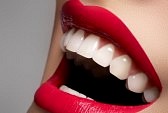 whiten teeth with hydrogen peroxide yahoo
