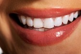 permanent teeth whitening manchester