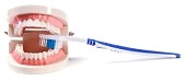 teeth whitening products that work uk