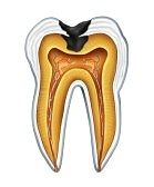 teeth whitening cost at dentist