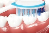 get teeth whitened at dentist