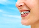 whitening teeth laser side effects