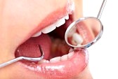 whiten teeth at home without hydrogen peroxide