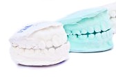 how much do professional teeth whitening cost