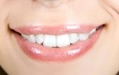 dentist whitening results