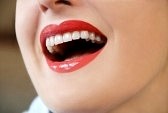 cost to whiten teeth at dentist