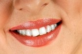 in office tooth whitening sensitivity