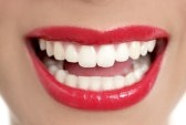 blue light teeth whitening system