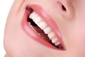 brite white teeth whitening system
