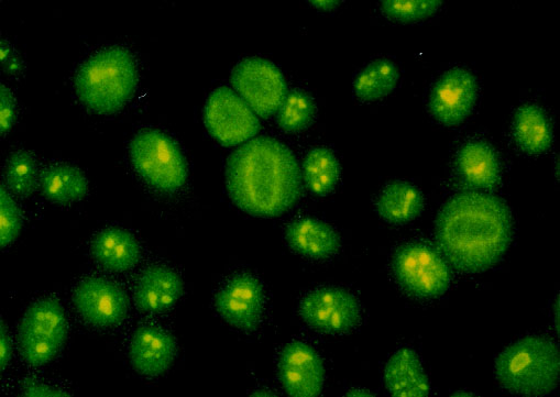 Fluoreszenzmuster Gesprenkelt Was Bedeutet Das www.geocities.ws