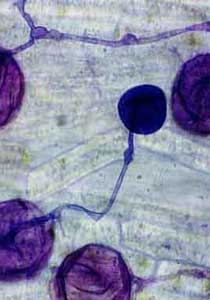 Esporas micorriza. Productos bi&oacute;ticos de &uacute;ltima generaci&oacute;n apuntan a corregir las enfermedades de las plantas con los llamados abonos vivos, extra&iacute;do de la microbiota (flora hongos-bacterias)