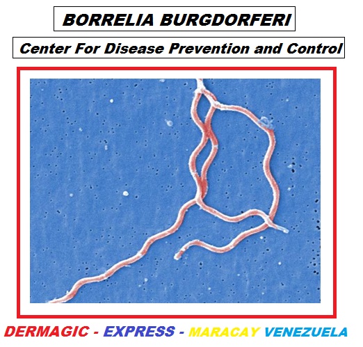 Borrelia Burgdorferi, etiological agent of LYME'S DISEASE, transmitted by the bite of a TICK