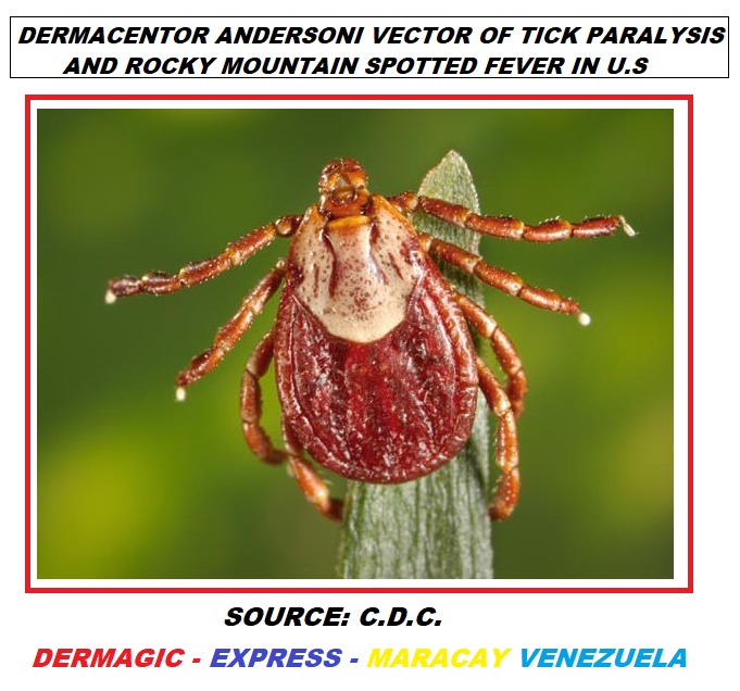 Dermacentor Andersoni, tick vector of Tick Paralysis and Rocky Mountain Spotted Fever in U.S.