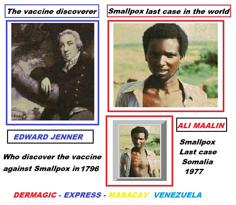 Edward Jenner, the discoverer of the smallpox vaccine (1796), and Ali Maalin, The last Case in The World (Somalia,1977).