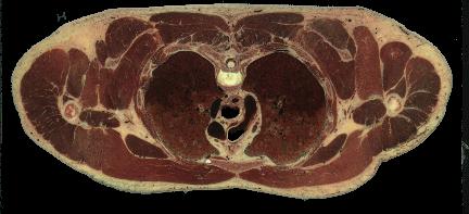Corte abdominal