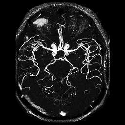 MRI-angiograf�a axial