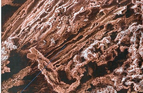 TUBULOS