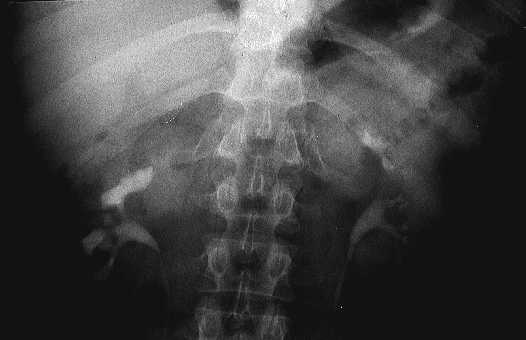 Urografia