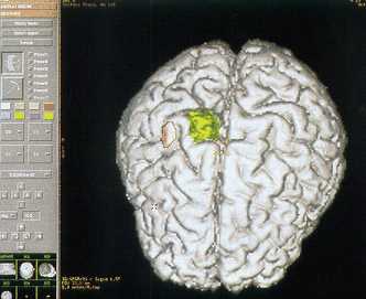 Cerebro 3D
