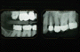 Dientes