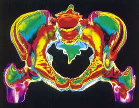 Pelvis
