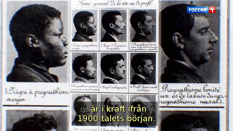 Lagarna i några av Amerikas stater om tvungen sterilisering av invalider, fattiga och svarta är i kraft sedan 1900-talets början. (Bild ur filmen &laquo;Det stora okända kriget&raquo;)