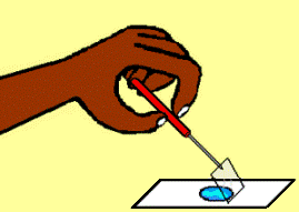 placing coverslip