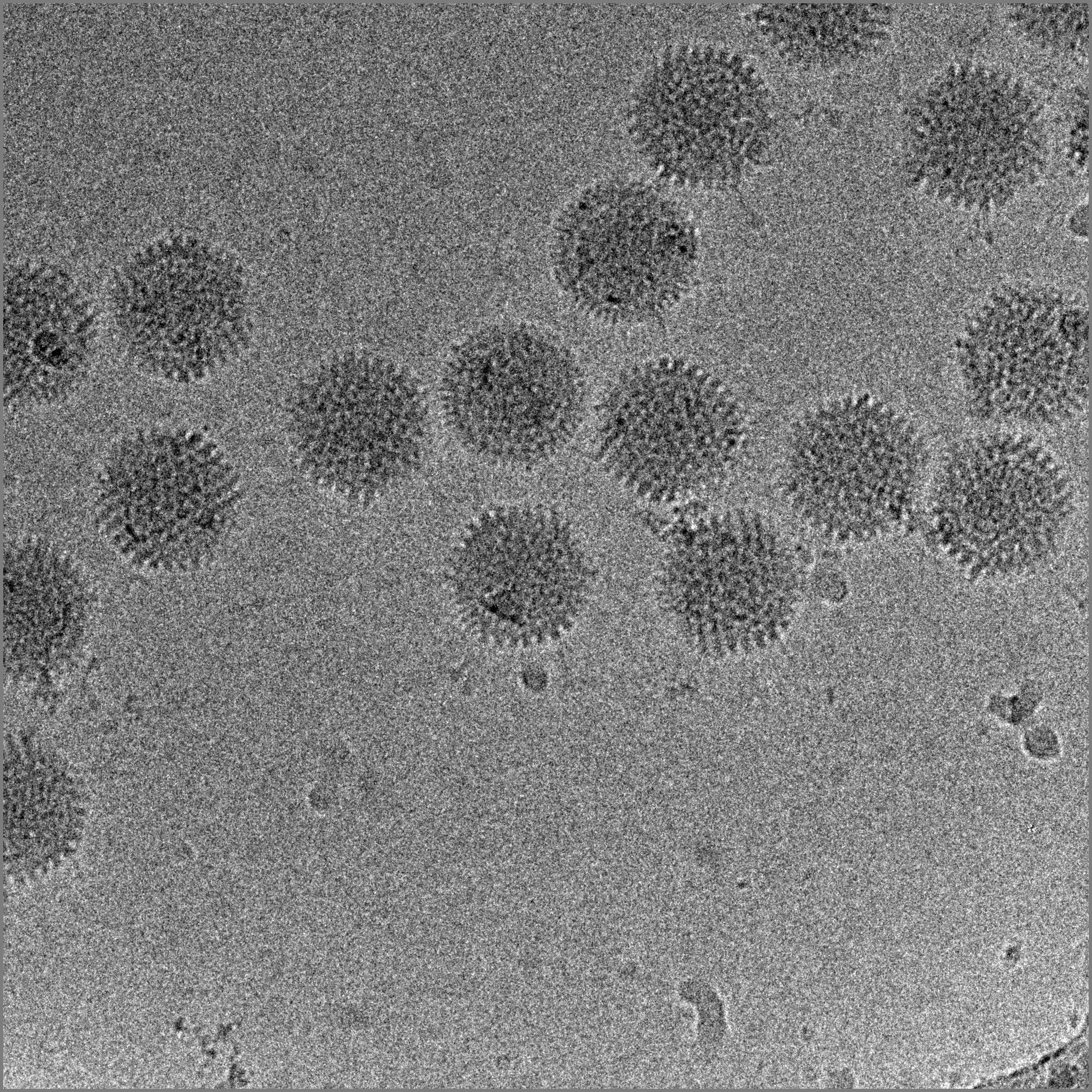 Фотографию вируса и названия. Вирус гриппа электронная микроскопия. Бактериофаг микроскопия. Вирус в электронном микроскопе. Вирионы вирусов под микроскопом.