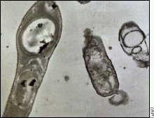 Imagen ampliada de la bacteria