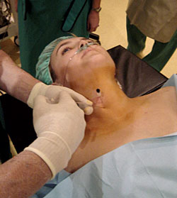 intradiscal