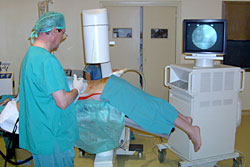 Dr Corzo Intervenci&oacute;n Nivel Lumbar
