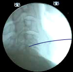 X-ray