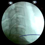 X-ray
