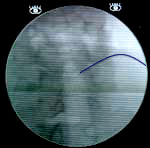 X-ray