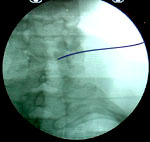 X-ray