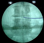X-ray
