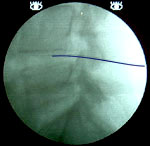 X-ray