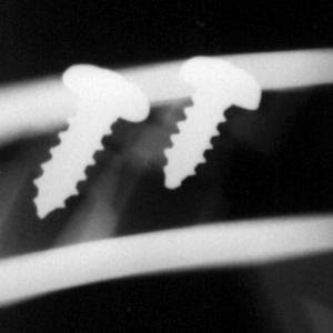 2x Screw