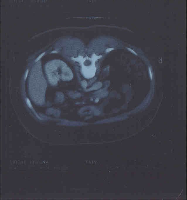 1 scan 15 december 2000.jpg (24215 bytes)