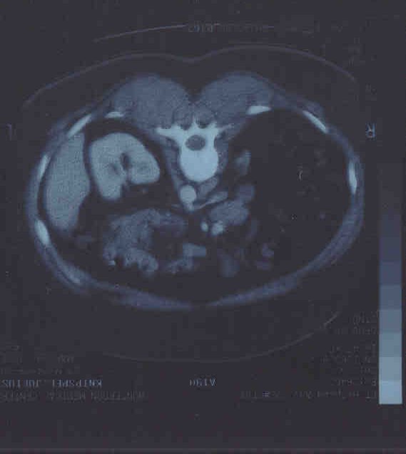 1 scan 29 march 2001.jpg (25610 bytes)