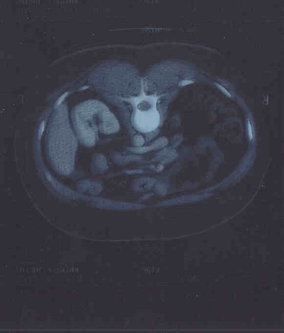 2 scan 15 december 2000.jpg (22650 bytes)