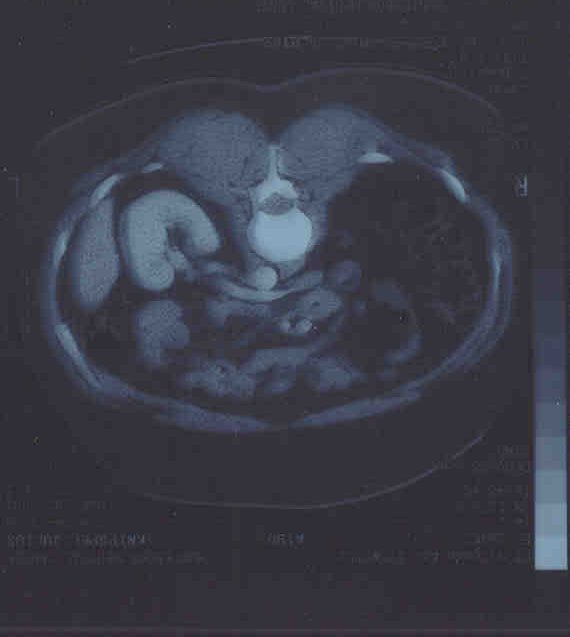 2 scan 29 march 2001.jpg (24794 bytes)