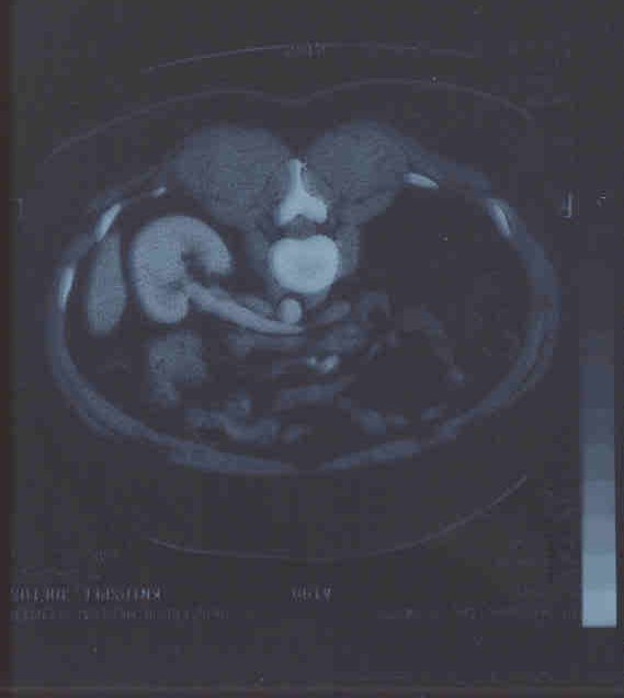 3 scan 29 mar 2001.jpg (21957 bytes)