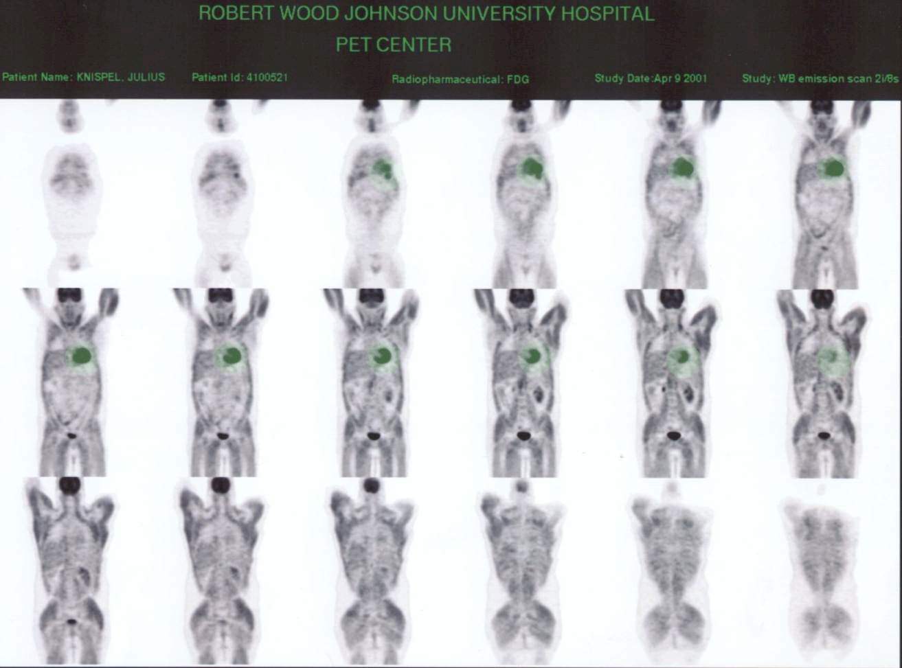 pet scan false color.jpg (80773 bytes)