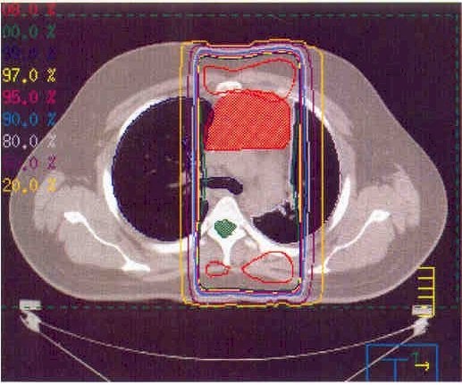 tumor1.jpg (64189 bytes)
